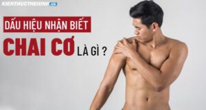review danh gia lipo 6 giam can co tot khong 3